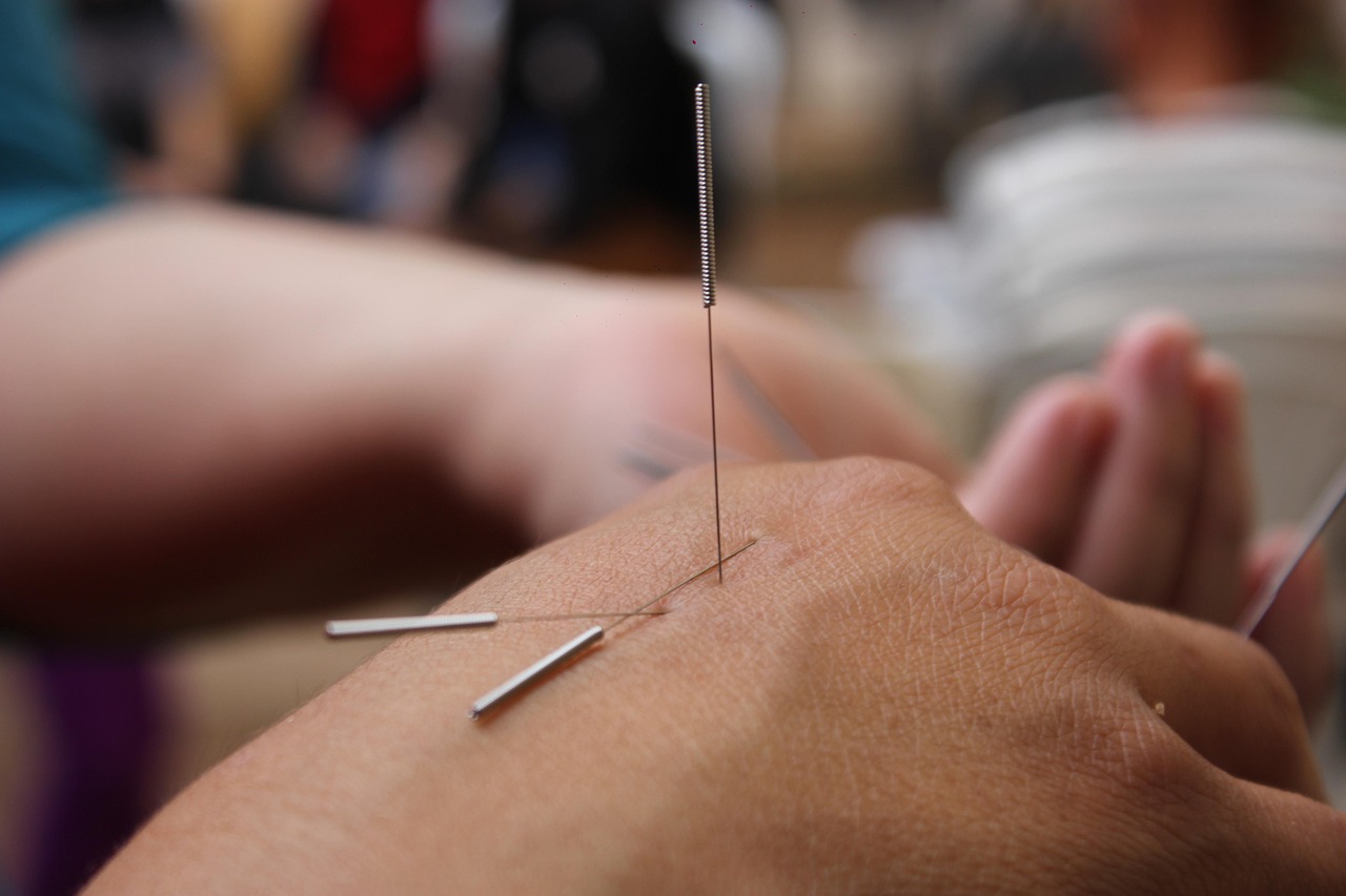 Effects of acupuncture on cancer-related fatigue and quality of life in breast cancer survivors: A systematic review and meta-analysis of randomized controlled trials.