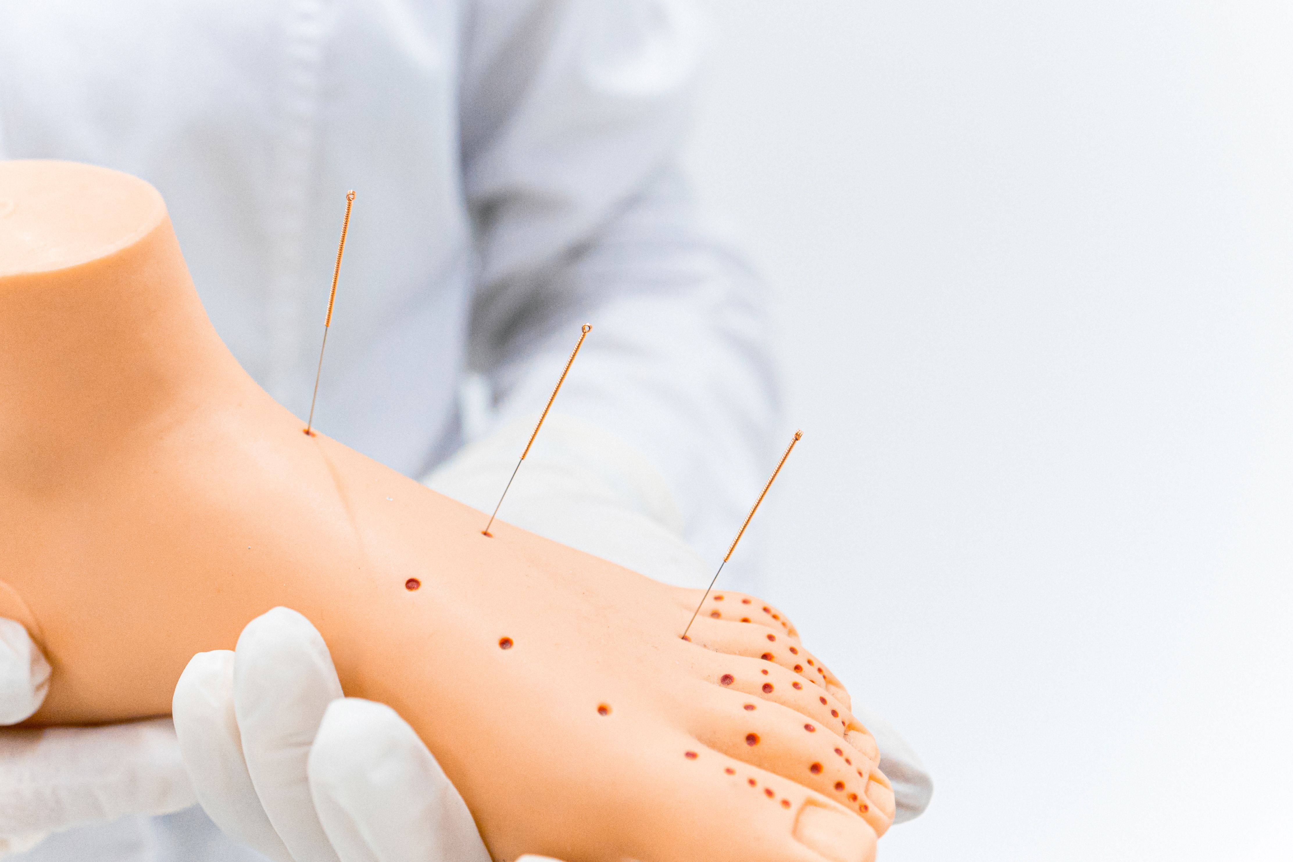 Analysis of factors influencing diabetic peripheral neuropathy in patients with type 2 diabetes mellitus and construction of a nomogram prediction model.