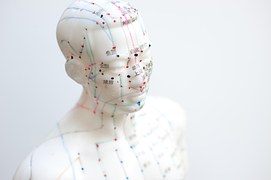 Combined Cupping and Acupuncture Therapy for Dorsocervical Fat Pad: A Series of Case Studies.