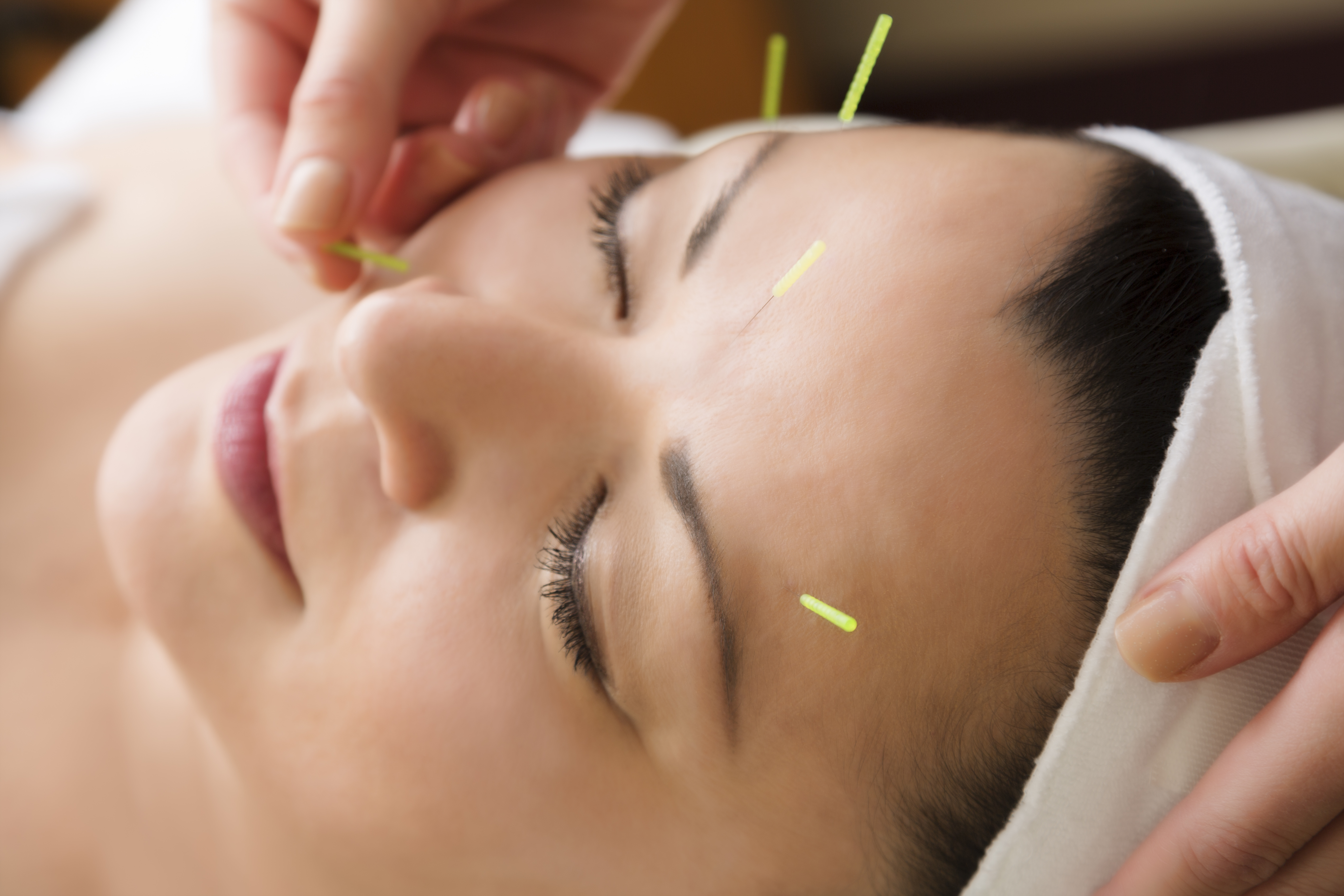 Electroacupuncture promotes the repair of lacrimal glands damage in dry-eye animal models by modulating the BDNF/CREB signaling pathway.
