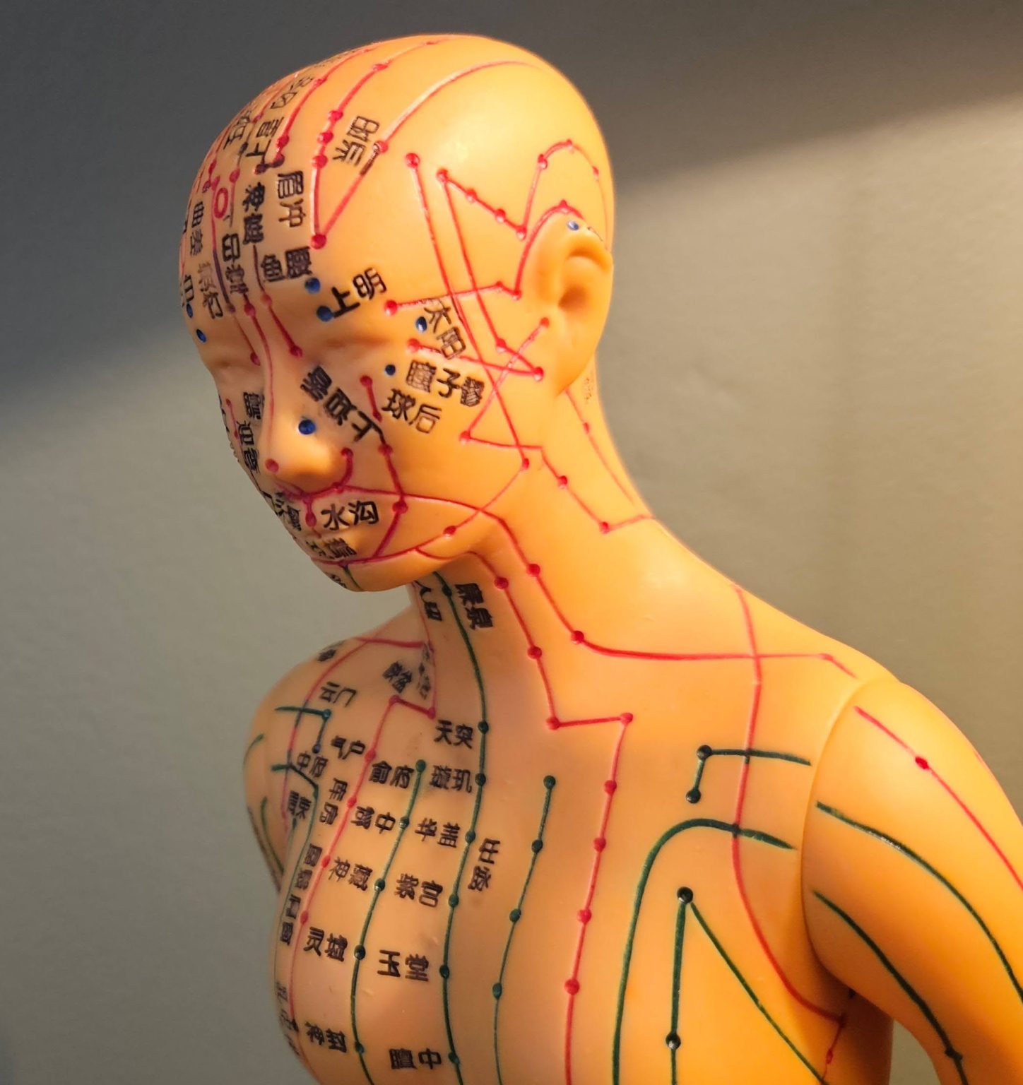 Adjunctive ultrasound-guided vagus nerve-targeted pharmacopuncture for refractory fibromyalgia with autonomic symptoms: a case report.