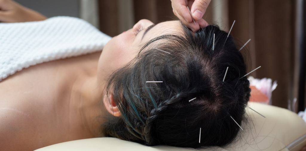 Acupuncture-related peripheral stimulation as a candidate neuromodulatory model of insomnia: clinical evidence, sleep-wake circuitry, and translational limits.