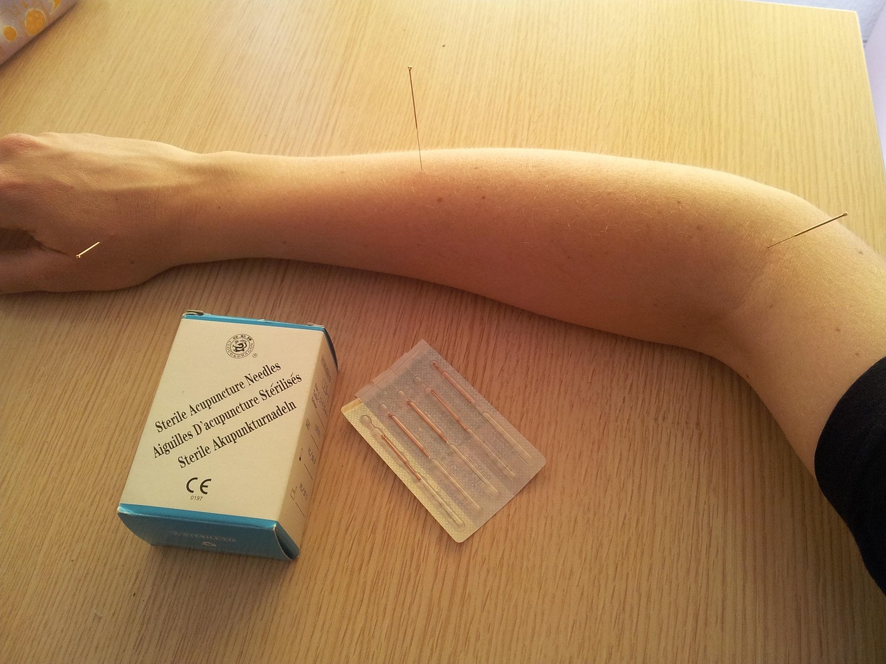 Myofascial Trigger Point-Augmented Acupuncture vs Conventional Acupuncture for Early- to Mid-Stage Knee Osteoarthritis: A Randomized Clinical Trial [Letter].