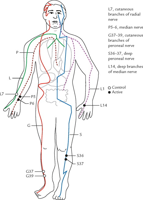Neuromuscular effects of warm needle acupuncture versus mild moxibustion in knee osteoarthritis: An active-controlled randomized trial.