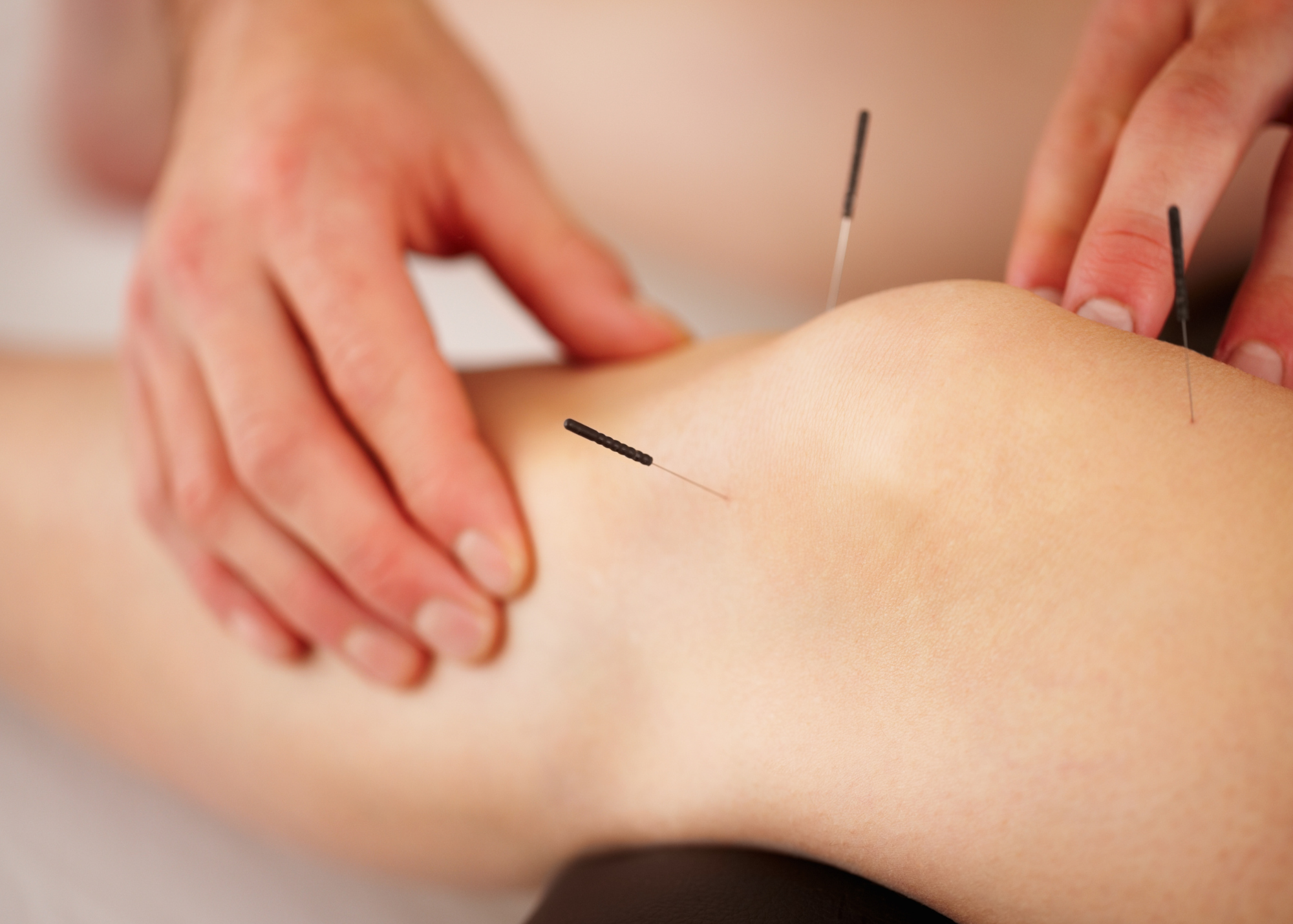 [Study on regulatory effects of warm needling moxibustion on chondrocyte senescence in rats with knee osteoarthritis].