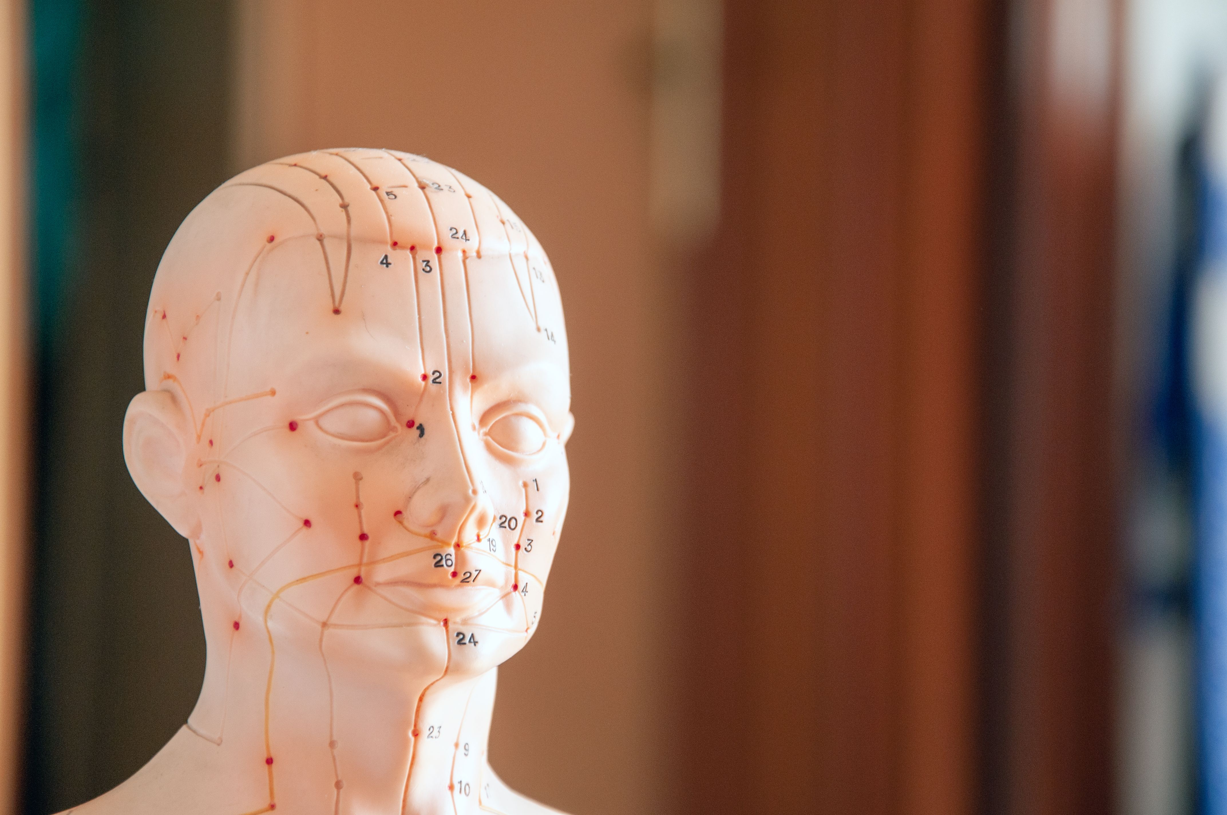 Acupuncture before planned admission for induction of labor (ACUPUNT study): a randomized controlled trial.