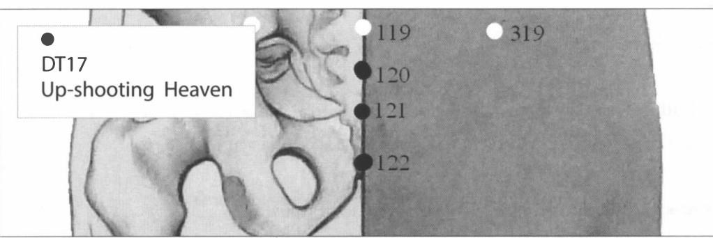 Схема точки Туна DT.17